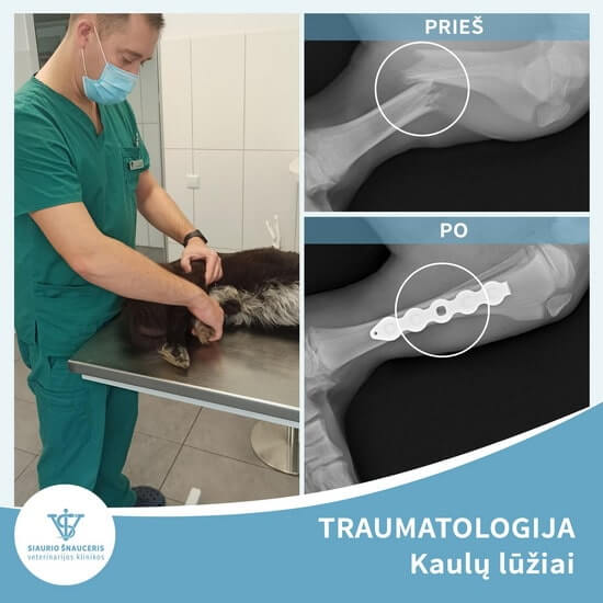 Traumatologija. Kaulų lūžiai
