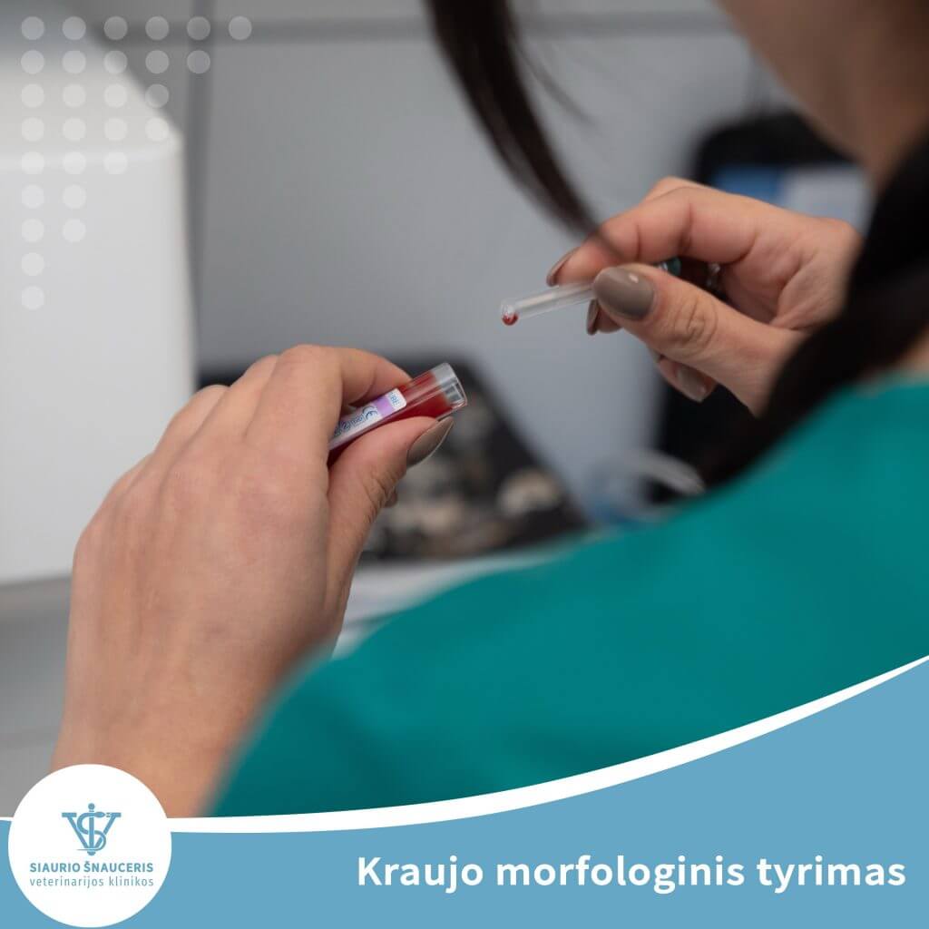 Kraujo morfologinis tyrimas