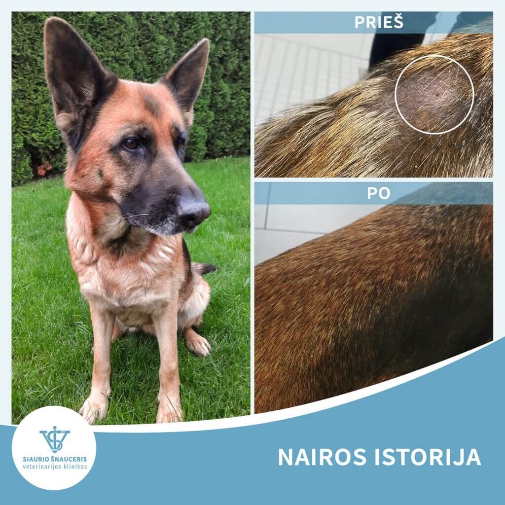 Nairos istorija – hipotiroidizmas