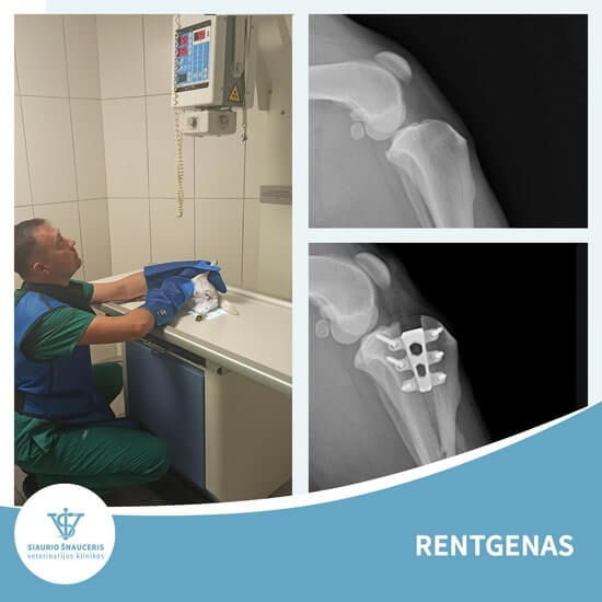 Rentgenas