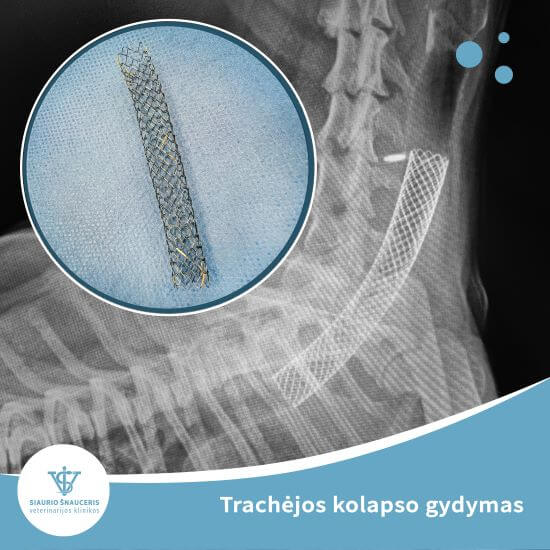 Trachėjos kolapso gydymas