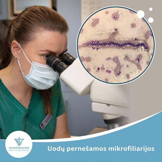 Mikrofiliarijos