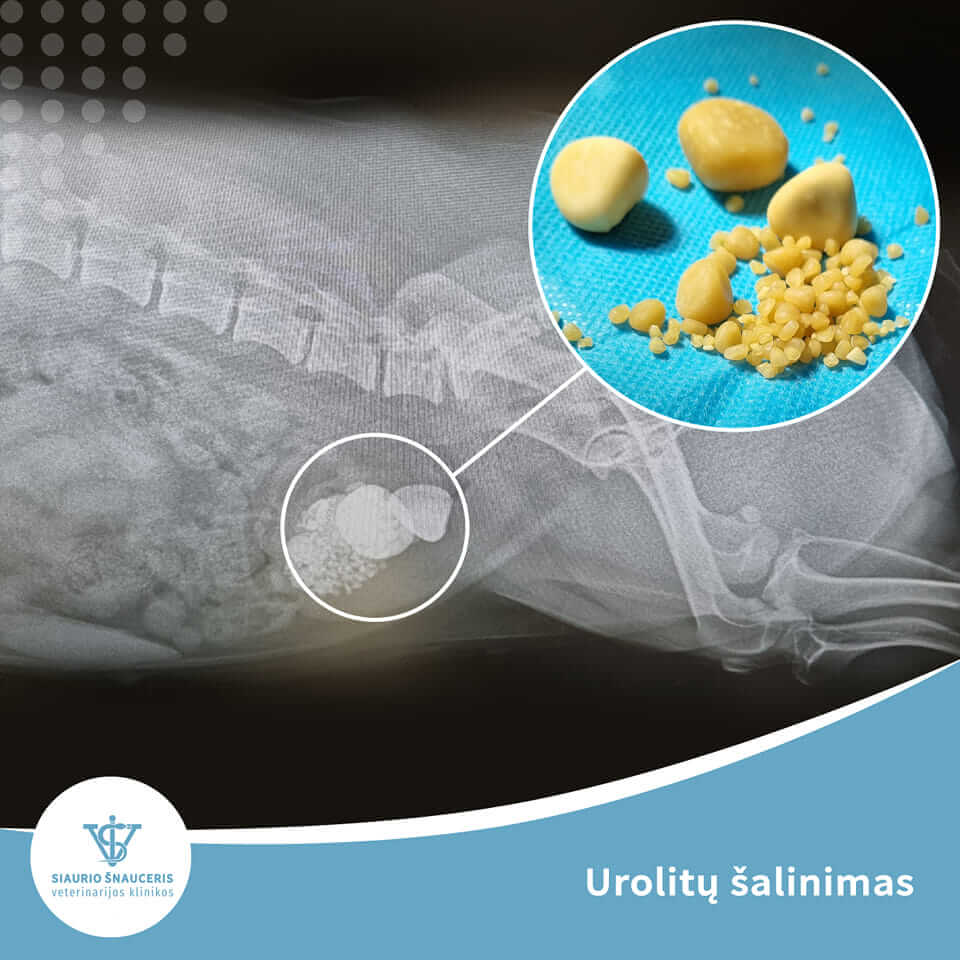 Urolitų šalinimas
