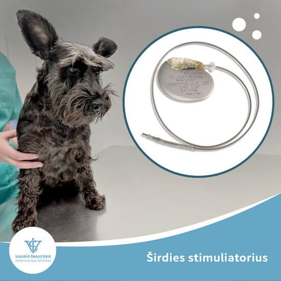 Širdies stimuliatorius